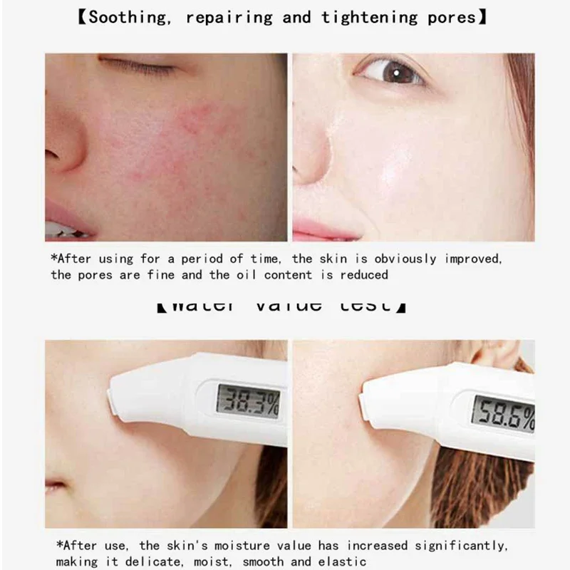 30 stücke Centella Kollagen Sc – Korean Skincare Routine Bewertung und Preis